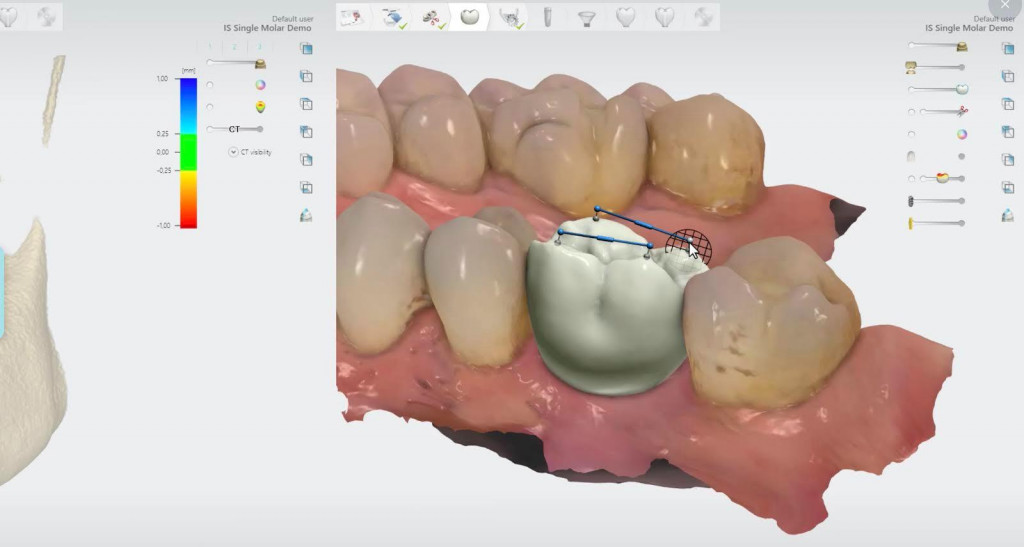 Prodentik - materiał partnera