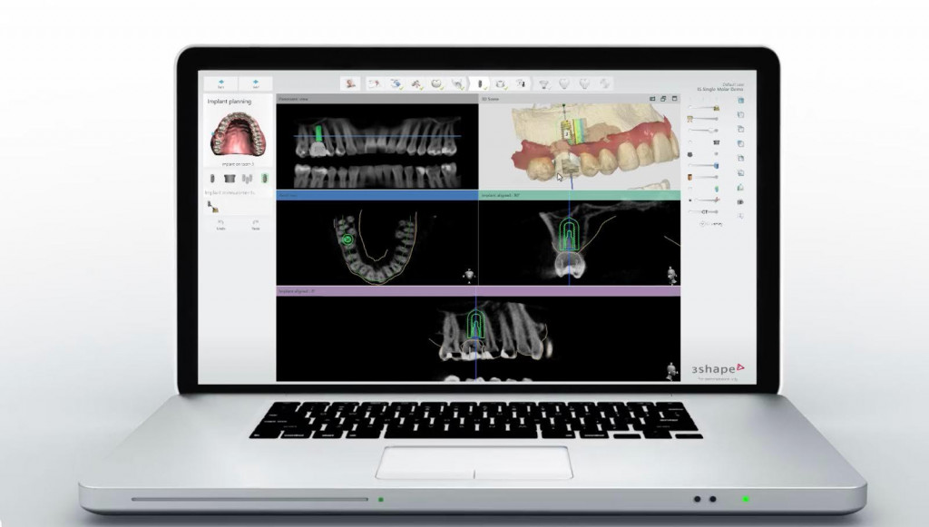 Prodentik - materiał partnera
