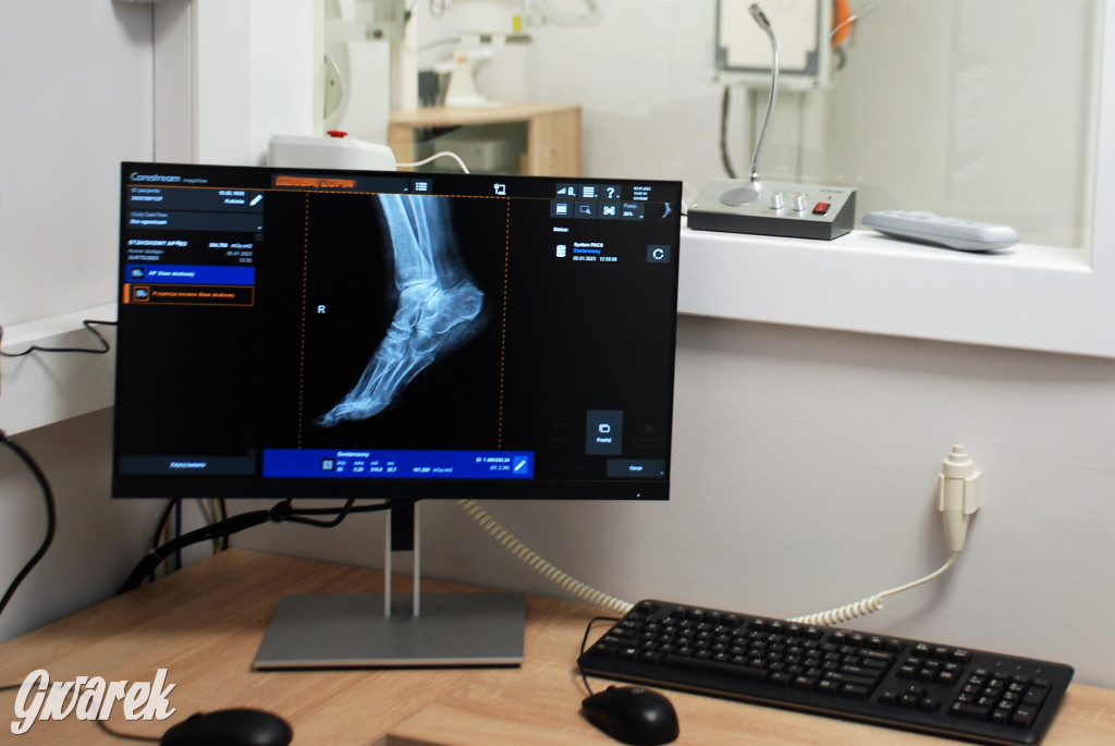 GCR ma nowy cyfrowy aparat rentgenowski