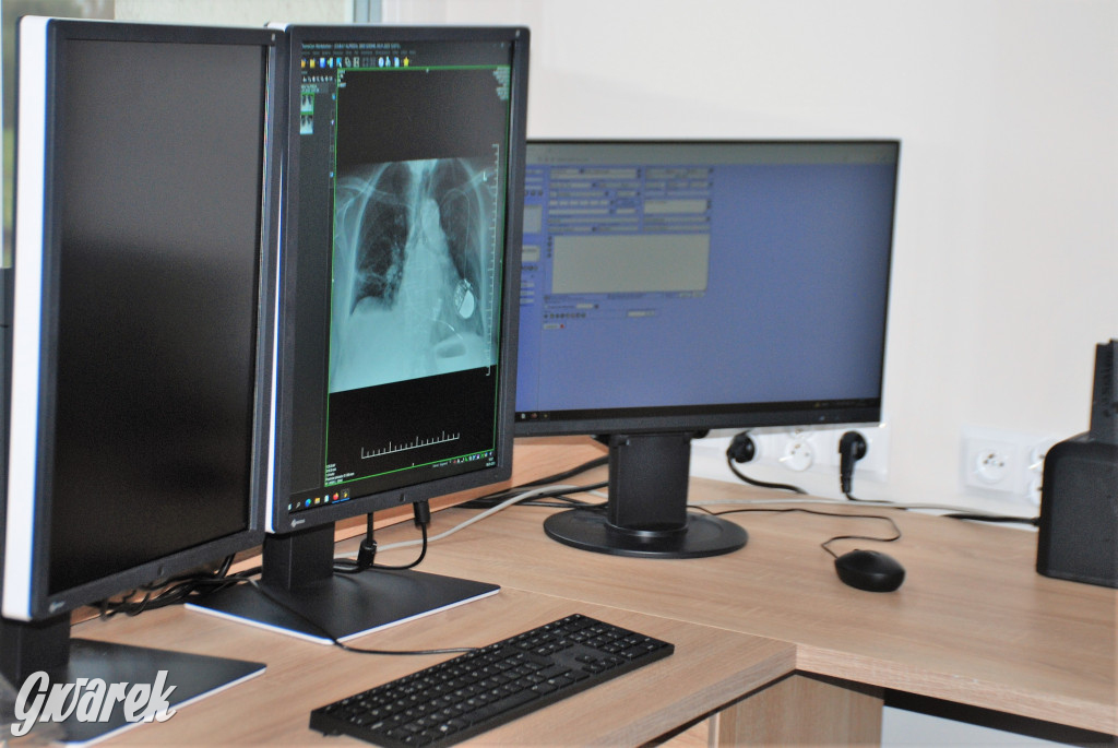 GCR ma nowy cyfrowy aparat rentgenowski