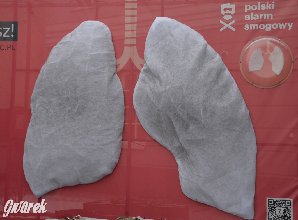 Płuca przy urzędzie. Już czyste nie są