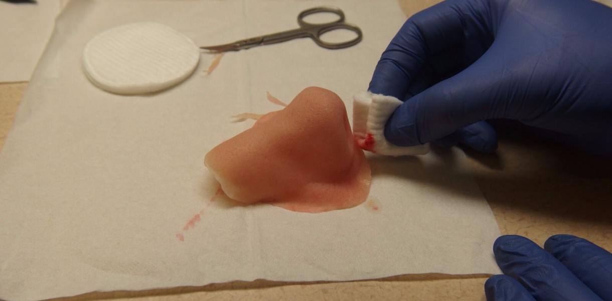 Nasza rozmówczyni wykonuje np. protezy nosa. Fot. Archiwum Dental Dialog