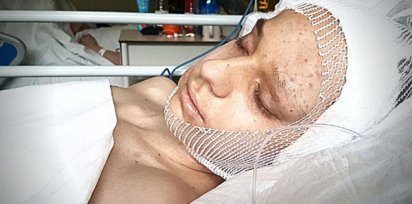 Michał Filipczyk. Fot. siepomaga.pl